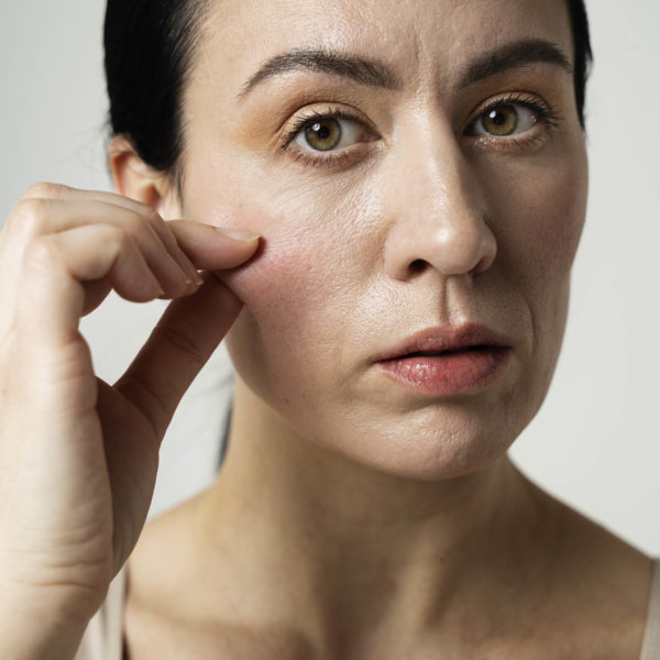 MATURE SKIN